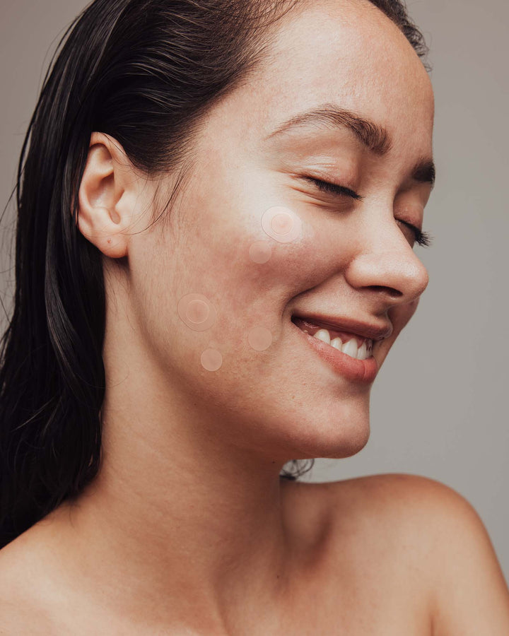 Revolutionize Your Acne Skincare Routine with Hydrocolloid and Microneedle Patches