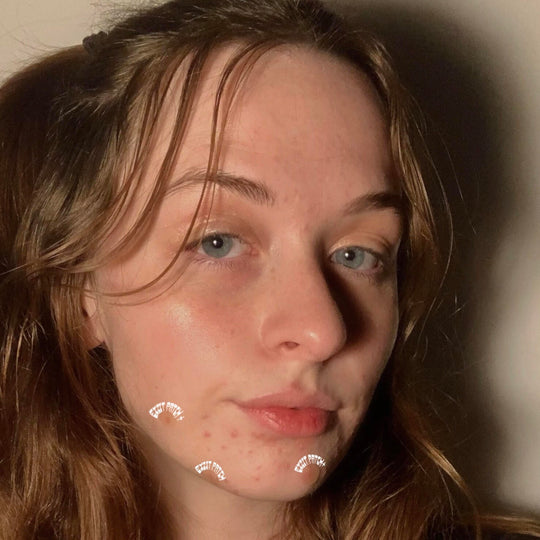 EXZIT PATCH OG