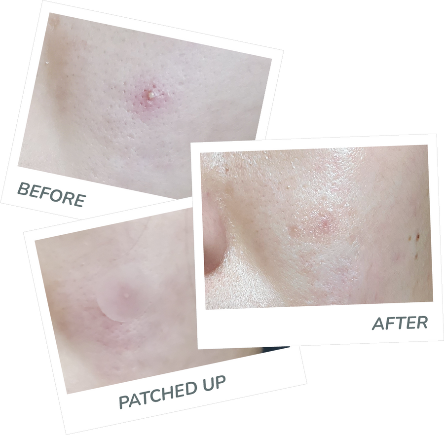 Exzit Patch XL